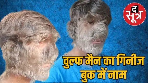 world-record-wolf-man