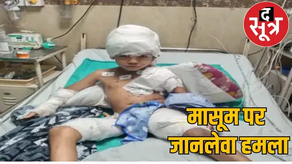 Street Dog Attack Raipur the sootr