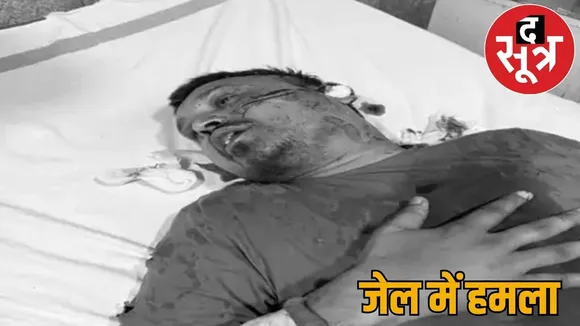 Congress leader close KK Srivastava attacked jail condition critical