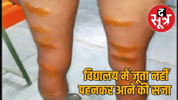 Teacher beats tribal student with cane for not wearing shoes in school the sootr