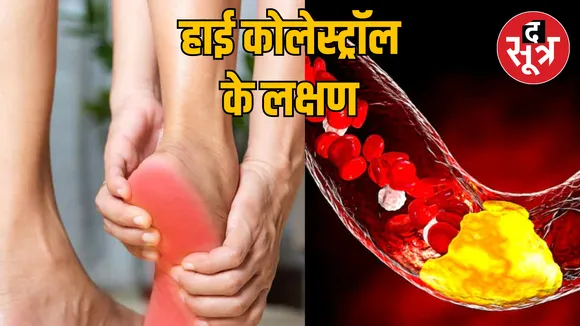 5 symptoms appear feet when cholesterol increases