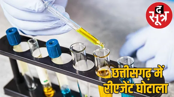 Urine box worth 66 rupees bought 23 thousand