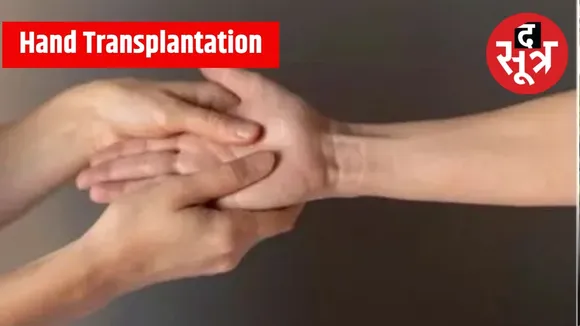 MP Hand Transplantation