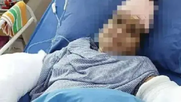 कट गई थी दोनों हाथ की कलाई, डॉक्टरों ने फिर जोड़ा, ससुर ने किया था बहू पर तलवार से वार