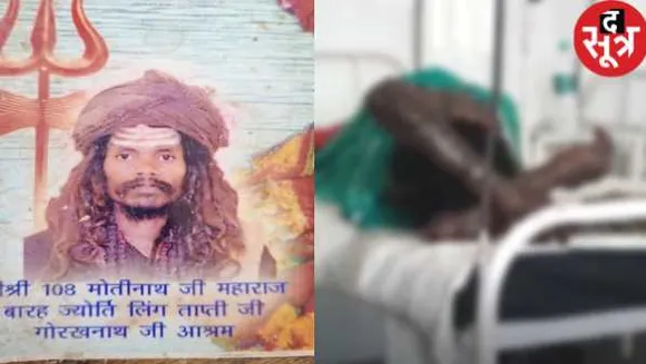 हैवान तांत्रिक: 11 हजार रुपए के लिए दंपती को जलाया, इलाज के दौरान पति की मौत