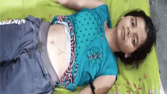ये अंधविश्वास है: किशोरी को अगरबत्तियों से दागकर भूत-प्रेत भगाने का दावा   