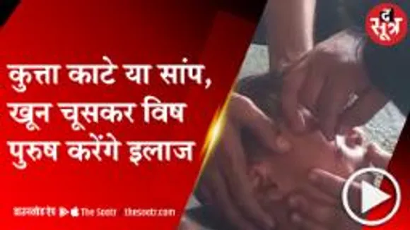 उज्जैन: खून चूसकर जहर का इलाज करने का दावा, ब्लेड से कट लगाकर निकालता है जहर 