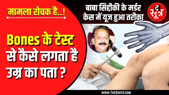Interesting | बाबा सिद्दीकी के Mur*der के आरोपी की उम्र का पता कैसे लगा ? Bone Ossification Test