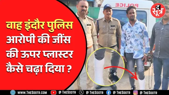 Indore Police ने फिर गजब ही कर डाला, आरोपी के पैर में जींस के ऊपर चढ़वाया प्लास्टर