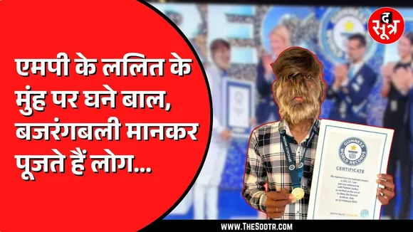 MP News | रतलाम के ‘Wolf Man’ का कमाल, बने Guinness Word Records होल्डर!