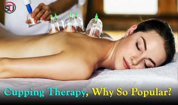 Why Is The Chinese Cupping Therapy Becoming So Popular? KNOW