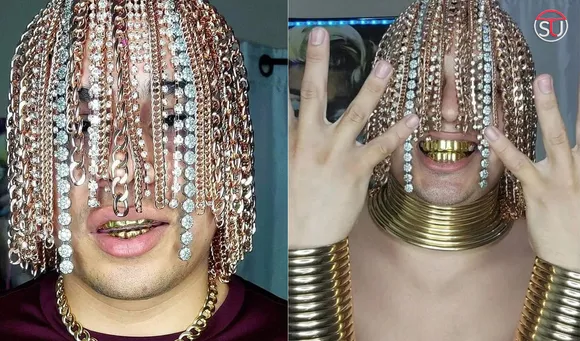Viral Pics: Mexican Rapper Dan Sur Gets Gold Chains Implanted In His Head