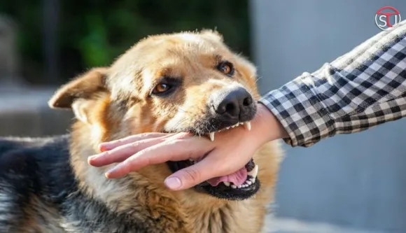 Got Bitten by Dog? Here's What to Do and Don't