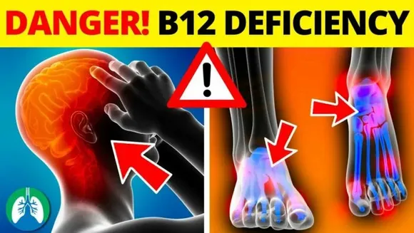 Always Tired? Folate (Vitamin B12) Deficiency Could Be The Reason, Know Signs and Symptoms