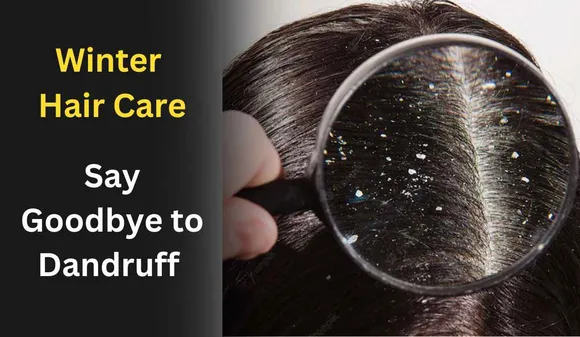 Winter Hair Care: Say Goodbye to Dandruff with this Home Remedies
