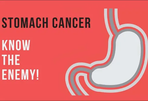 Stomach Cancer : Do Not Ignore These 5 Common Types Of Symptoms, Prevention And Tips