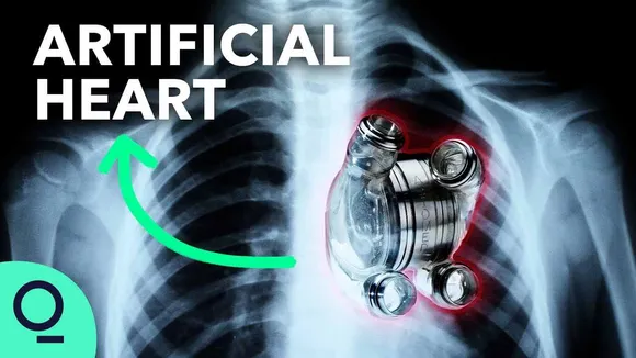 Artificial Hearts : The Dream Of Man-Made Hearts, How Close We Are ?