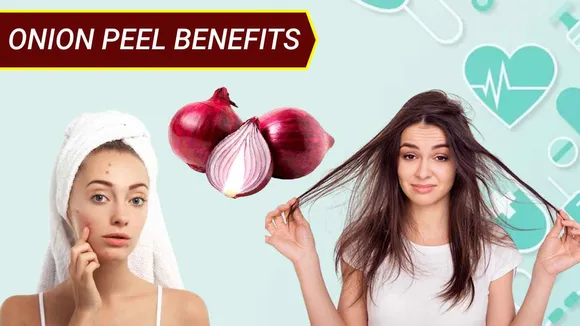 Onion Peel Benefits: It is not wise to throw away onion peels, if you use them like this then great things will be done!
