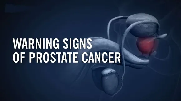 Prostate Cancer : Here Are The Warning Signs of Prostate Cancer You Should Not Ignore !