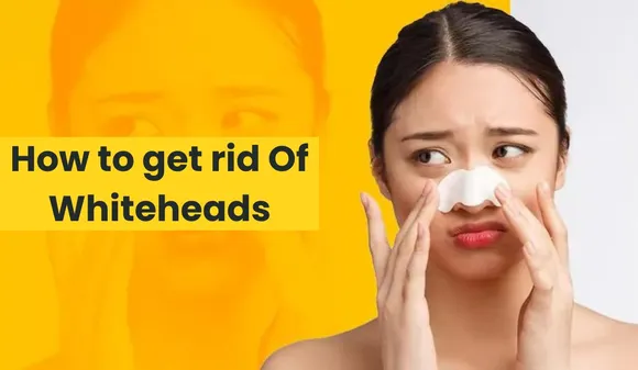 Whiteheads on Your Nose, Then Adopt these Home Remedies to get rid of Them