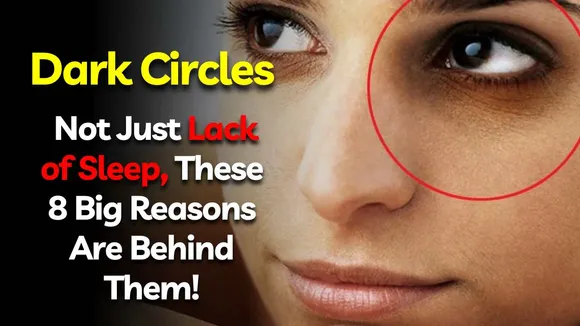 Dark Circles: Not Just Lack of Sleep, These 8 Big Reasons Are Behind Them!