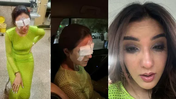 Jasmine Bhasin Attends Event Despite Severe Eye Pain from Contact Lenses