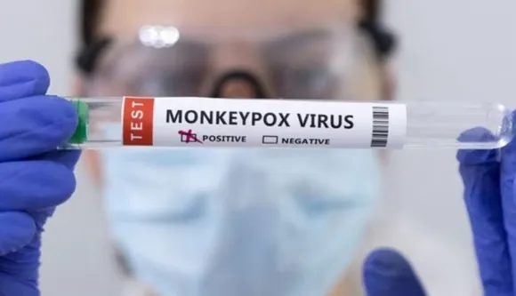 Monkeypox: WHO Declares A New Health Emergency, Know Its Symptoms