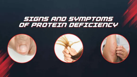 Are You Taking Enough Protein ? Or Do You Have Protein Deficiency? Know Symptoms and Tips To Fix