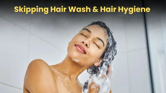 Skipping Hair Wash & Hair Hygiene: Causes of Hair Fall, Dandruff & Scalp Problems