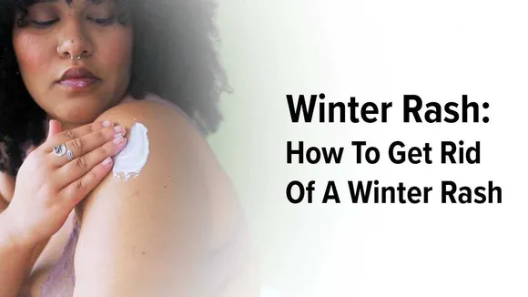 Suffering From Winter Rash ? Experts Suggests Top Tips To Control !