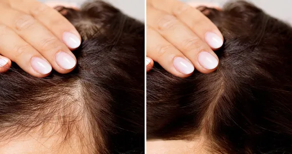 hair growth biotin.jpg
