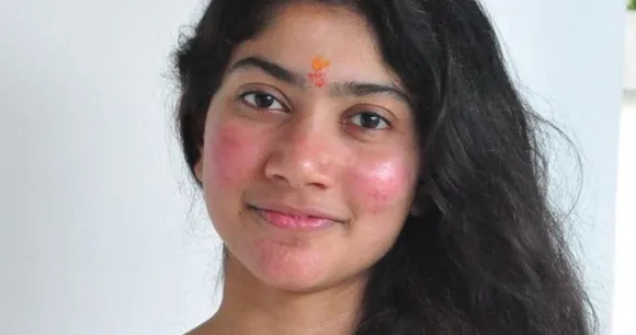 pimples and acne.jpg