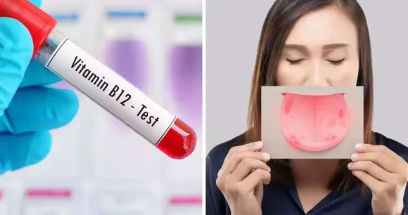 b12
