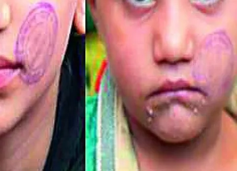 சிறையில் உள்ள உறவினரை பார்க்க சென்ற குழந்தைகளின் முகத்தில் முத்திரை குத்திய நிர்வாகம்