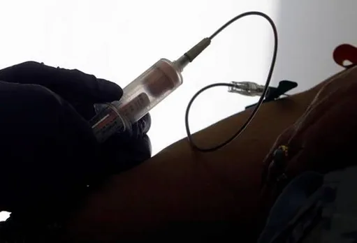 HIV On Blood Transfusion, Chennai Women With HIV Blood, கர்ப்பிணிக்கு ஹெச்.ஐ.வி. ரத்தம்