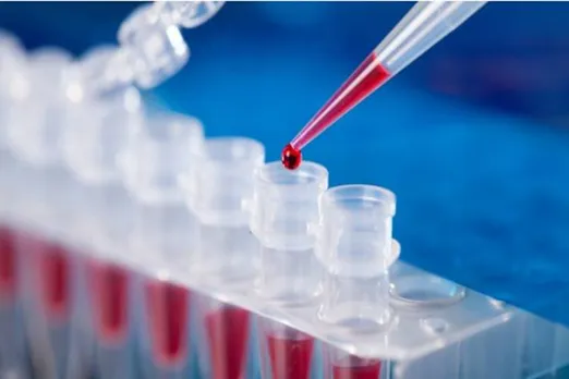 corona test samples lab technicians madras high court