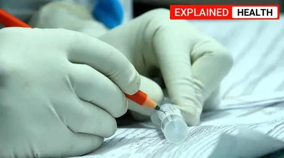 covid-19, blood test heart patients covid-19, கோவிட்-19, இதய நோயாளிகளுக்கு புதிய ரத்தப் பரிசோதனை, கொரோனா நோயாளிகளுக்கு சிகிச்சை, Blood test for heart patients, the University of Alberta, covid-19 blood test, Tamil indian express explained