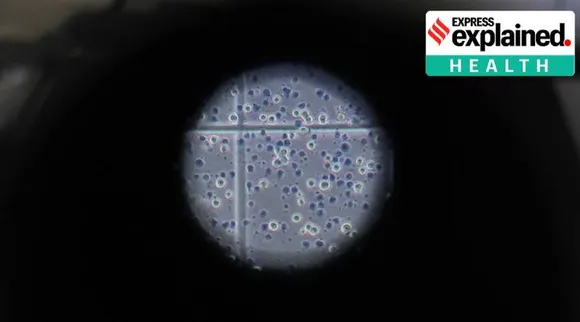 coronavirus, covid-19, tamil indian express explained health, How effective is plasma therapy, கொரோனா வைரஸ், பிளாஸ்மா சிகிச்சை, ஹூஸ்டன் மெத்தடிஸ்ட், plasma therapy for Covid-19