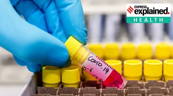 ‘Not all will get vaccine quickly, need to come up with strategy’: Dr Gagandeep Kang