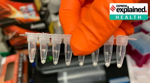 covid-19, pcr test