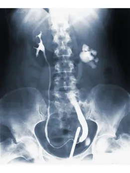 kidney - unsplash (1)