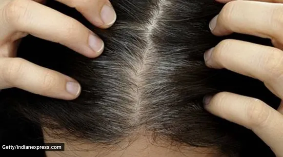 Grey premature greying hair care dietary tips Tamil News