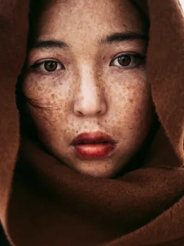 acne 11 - unsplash (1)