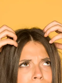 dry scalp (1)