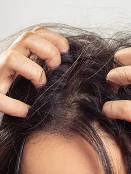 itchy scalp - unsplash (1)