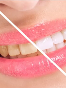 yellow tooth 1 - unsplash (1)