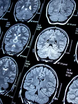 brain 7 - unsplash (1)