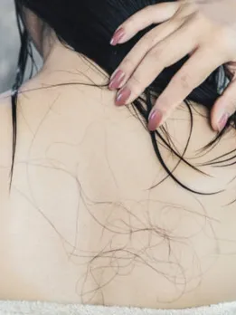 hair fall 12 - unsplash (1)