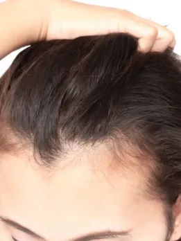 hair growth 1 - unspalsh (1)