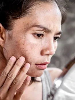 skin damage - unsplash (1)